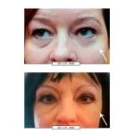 No.1 Lift Crème contour des yeux 15 ml