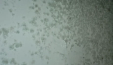 Méthodes efficaces pour lutter contre la moisissure sur le mur